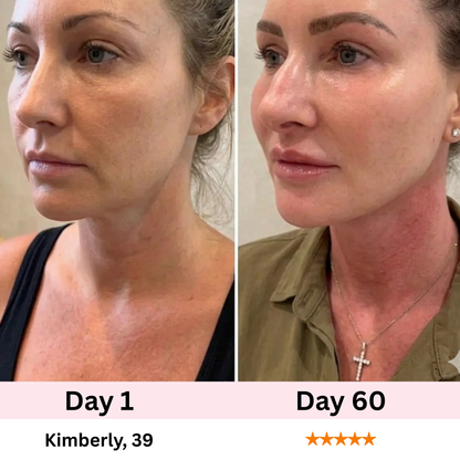 Sélene 7-in-1 LED Facial Sculptor