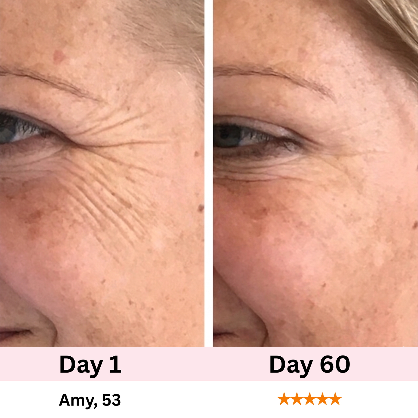 Sélene 7-in-1 LED Facial Sculptor